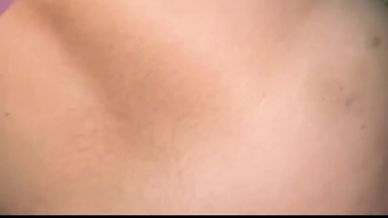 Frame 8