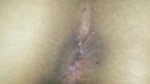 Desi ass gape farting sexy gand