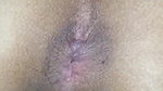Desi ass gape farting sexy gand