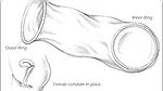 Don’t use the wrong way Condom Use Mistakes (Hindi)